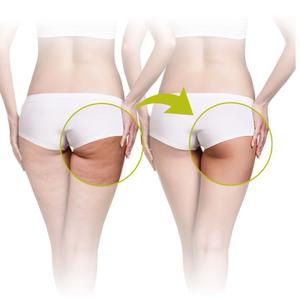 Anti-Cellulite-Massagegerät Lanaform Cell Roller image-3