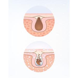 Gesichtspflege Lanaform 70W image-3