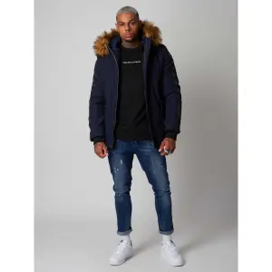 Parka a strisce Project X Paris image-2