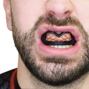 Mouthguards Safejawz Nitro Black/Red image-3
